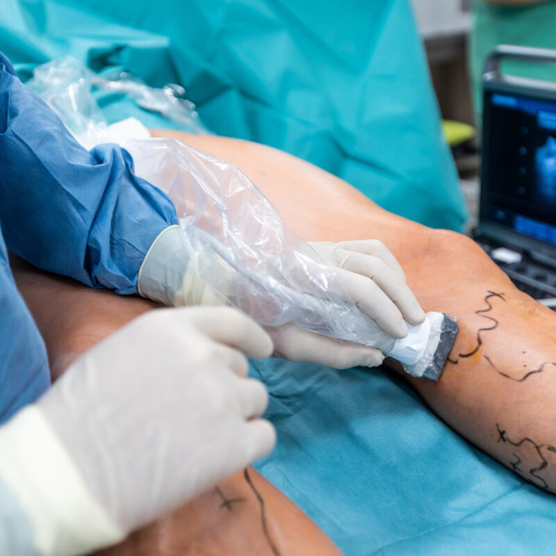 Vascular Surgery